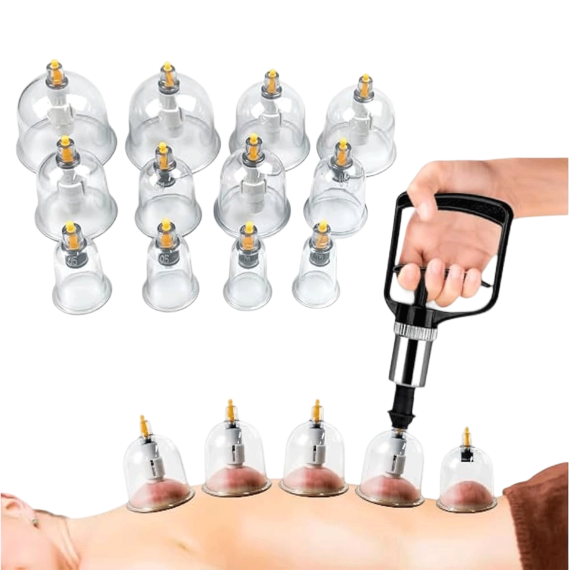 كاسات مساج حجامة cupping 2 , EGY HEALTH