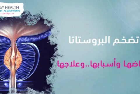 تضخم البروستاتا واعراضها واسبابها وعلاجها Enlarged prostate. symptoms. reasons. treatment, Egy Health